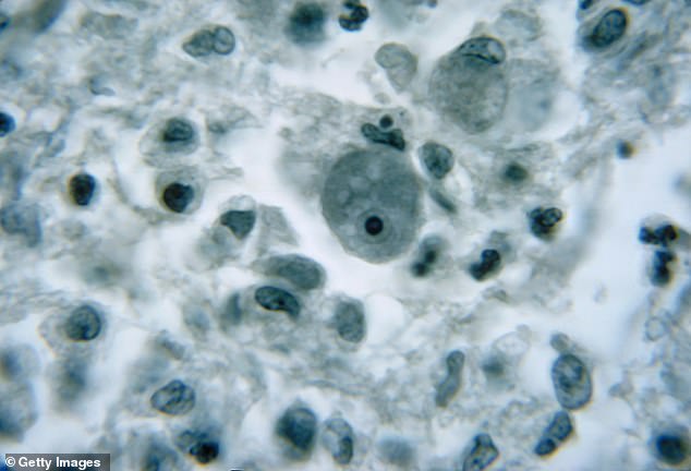 Naegleria fowleri (foto) biasanya ditangkap begitu air yang terkontaminasi memasuki tubuh melalui hidung, menurut Pusat Pengendalian dan Pencegahan Penyakit AS.