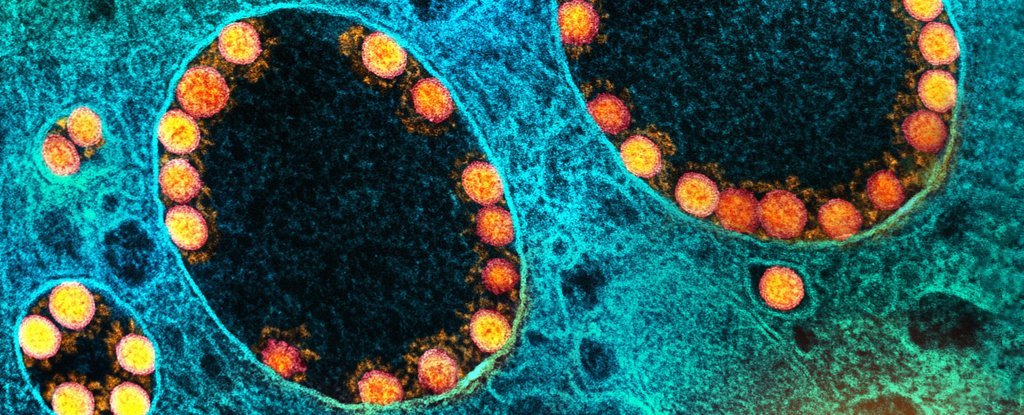 Virus paling awal yang terkait dengan SARS-CoV-2 ditemukan, ditemukan pada kelelawar