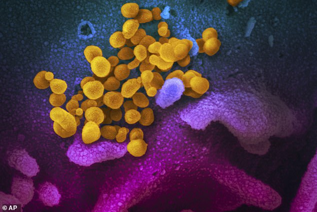 Para peneliti di San Diego menerima hibah dari NIAID untuk mengerjakan vaksin yang bisa efektif pada semua bentuk virus corona saat ini dan di masa depan.  Selain Covid, itu juga akan efektif melawan MERS dan SARS.  Foto: Sel COVID-19 ditangkap di bawah mikroskop