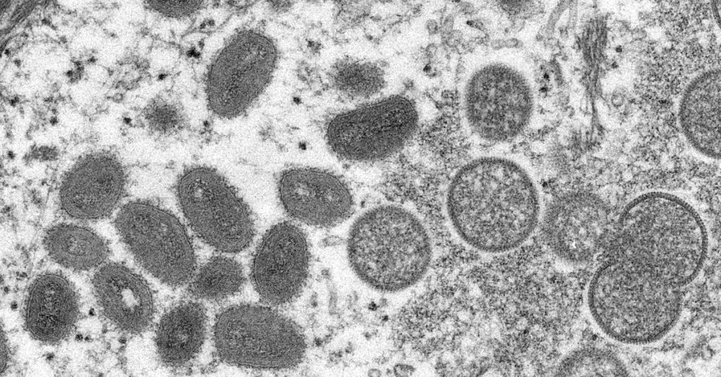 Massachusetts mengidentifikasi kasus pertama virus cacar monyet di Amerika Serikat pada tahun 2022