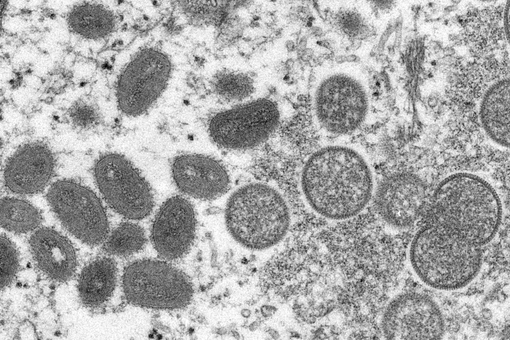 DC Health mempelajari kemungkinan pertama kasus monkeypox