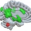 Ini menunjukkan lokasi otak kecil di otak