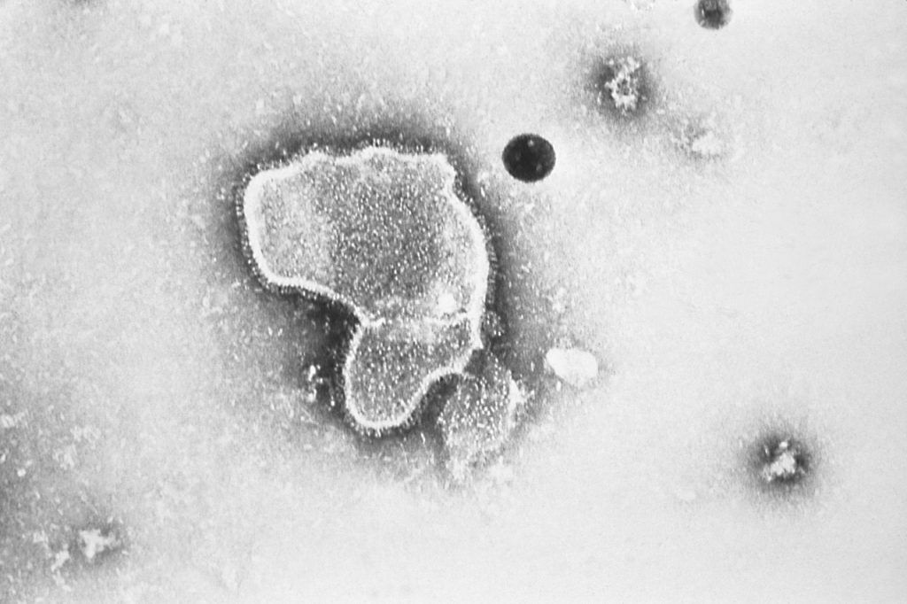 Orange County menyatakan darurat kesehatan karena kasus influenza dan virus pernapasan syncytial