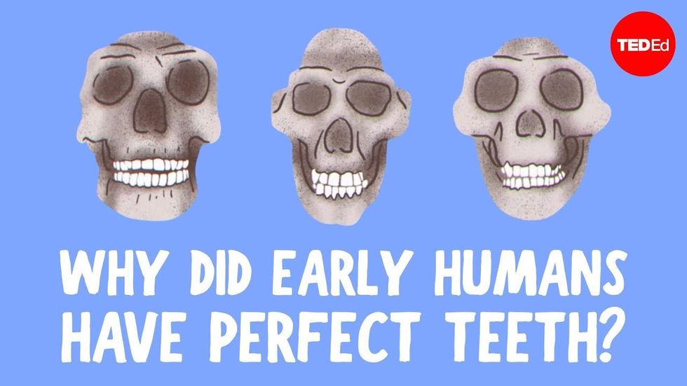 Video tersebut menjelaskan mengapa manusia purba secara alami memiliki gigi lurus dan kita tidak