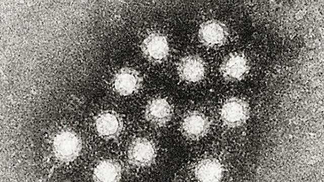 CDC memperingatkan kemungkinan paparan hepatitis A di Marco's di Lewiston