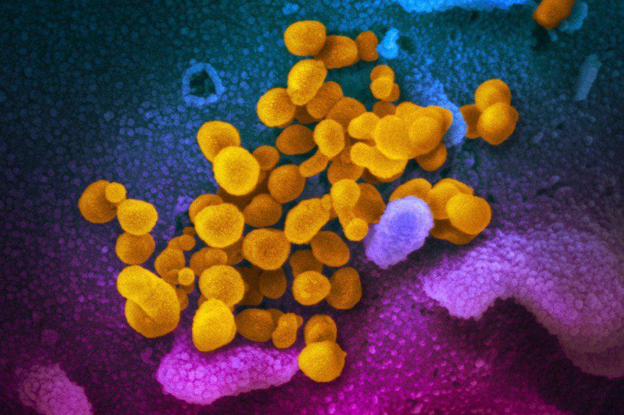 FILE - Mikrograf berwarna tak bertanggal ini yang disediakan oleh Institut Kesehatan Nasional AS pada bulan Februari 2020 menunjukkan virus corona baru SARS-CoV-2, ditandai dengan warna kuning, muncul dari permukaan sel, ditandai dengan warna biru/merah muda, tumbuh di laboratorium .  Sampel diisolasi dari seorang pasien di Amerika Serikat.  Ada risiko lebih rendah terjadinya long Covid di era Omicron dibandingkan gelombang pandemi sebelumnya, menurut sebuah penelitian terhadap hampir 10.000 orang Amerika yang bertujuan membantu para ilmuwan lebih memahami kondisi misterius tersebut, yang diterbitkan di JAMA pada Kamis, 25 Mei 2023. ( NIAID- RML melalui AP, file)