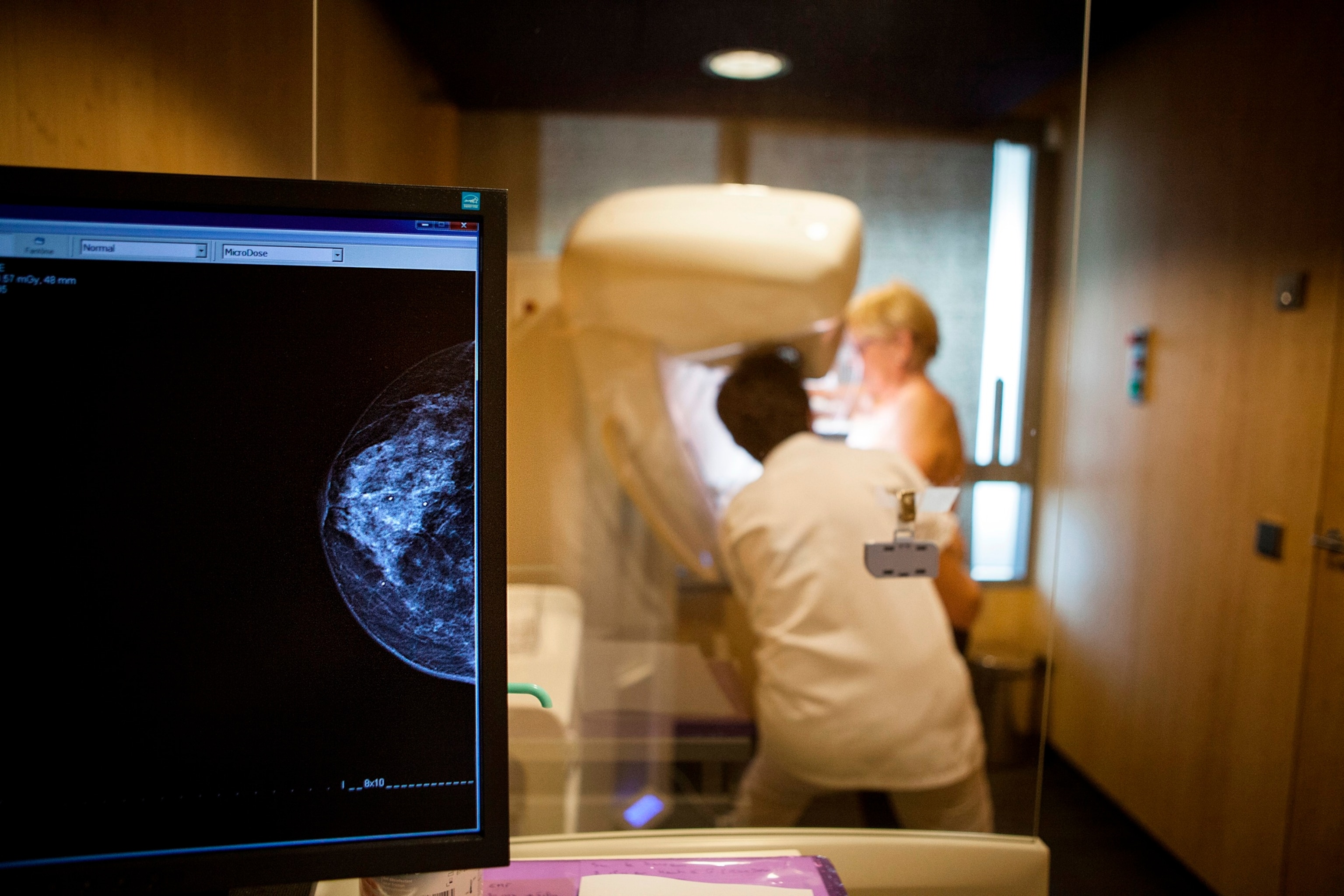 FOTO: Dalam file foto 30 November 2016 ini, seorang teknisi melakukan mammogram rutin.