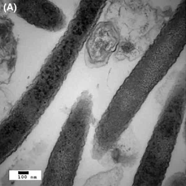 Mikrograf elektron Fusobacterium nucleatum ditampilkan.