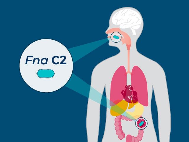 Subspesies bakteri Fusbacterium nucleatum, yang ditemukan di mulut, dapat membantu perkembangan dan pertumbuhan kanker kolorektal, kata para peneliti.