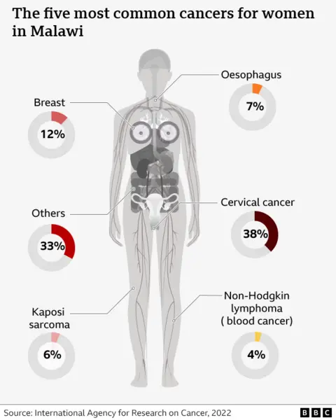 Diagram tubuh manusia yang menunjukkan lima jenis kanker paling umum pada wanita di Malawi. Kanker serviks merupakan kanker yang paling umum, disusul kanker payudara, esofagus, sarkoma Kaposi, dan limfoma non-Hodgkin. 